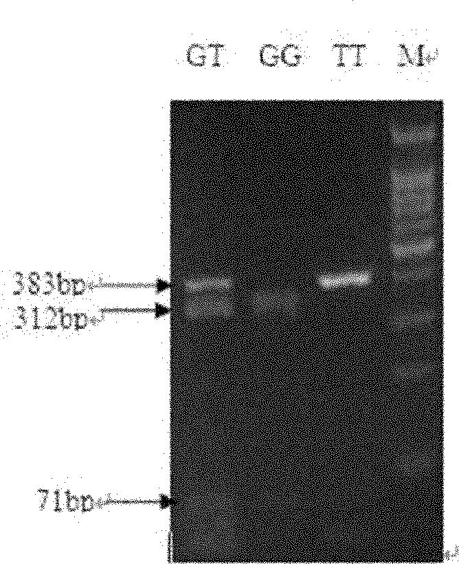 與豬免疫性狀相關的蛋白及其編碼基因和套用