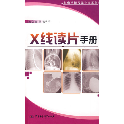 X線讀片手冊—影像學讀片掌中寶系列