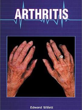 Arthritis(Willett, Edward著圖書)