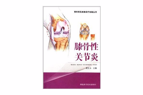 骨科常見疾病診療經驗叢書：膝骨性關節炎