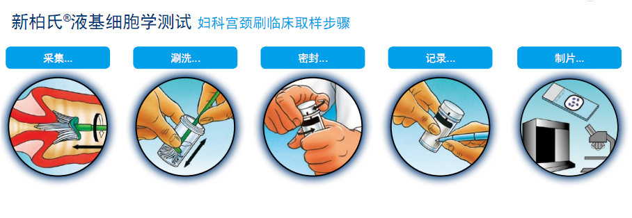 新柏式液測細胞學測試取樣步驟圖示