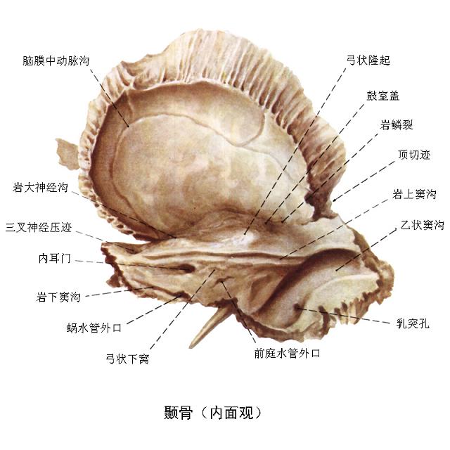 岩尖綜合徵