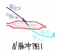 套管針治療機理1