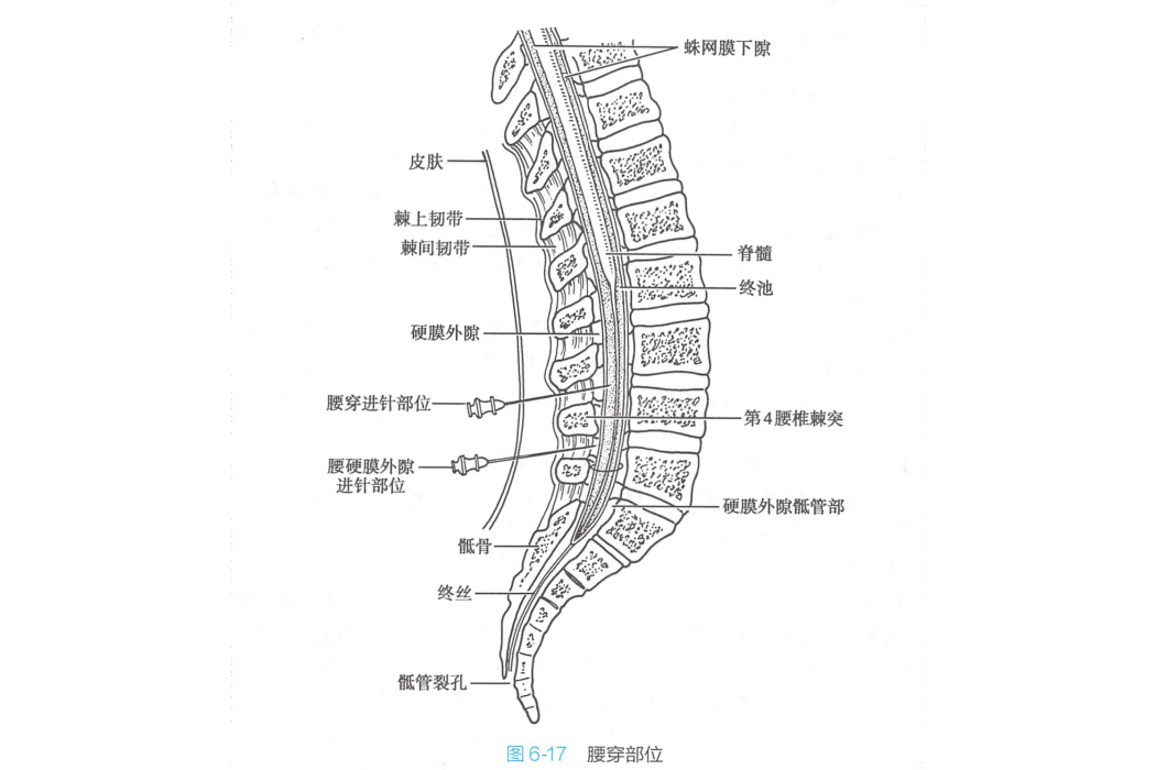 終池(蛛網膜下隙在第1腰椎至第2骶椎水平高度擴大)