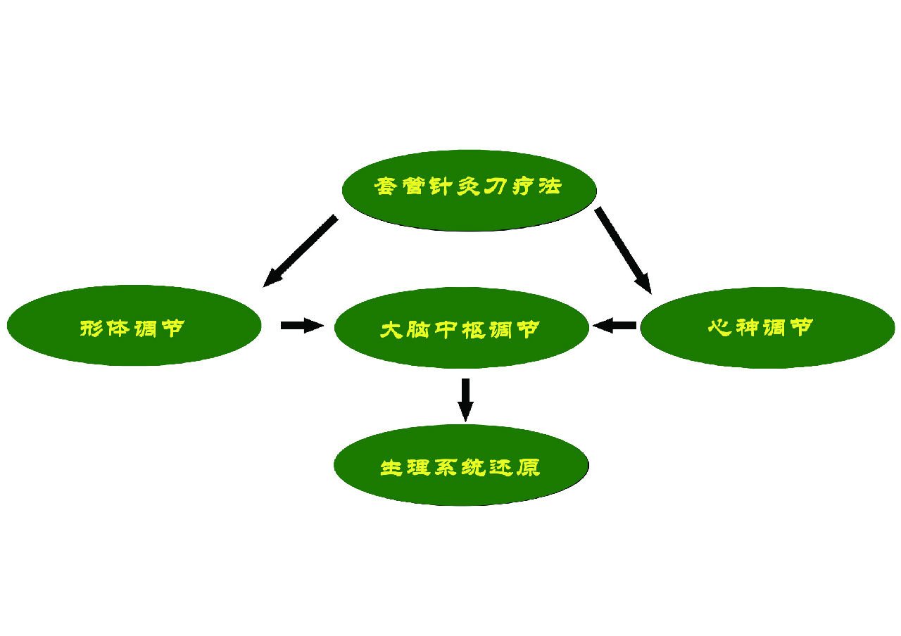 套管針灸刀療法