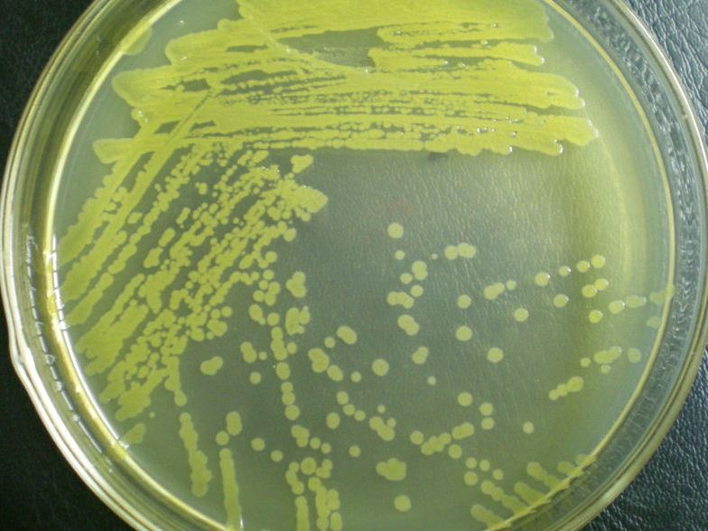 嗜鹼微生物