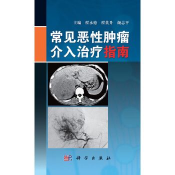 常見惡性腫瘤介入治療指南