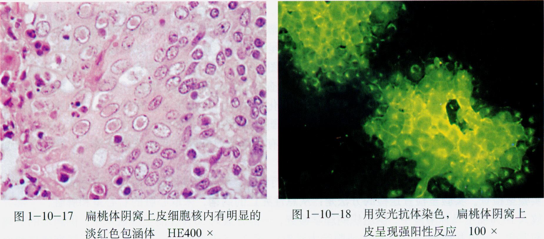 流行性乙型腦炎病毒