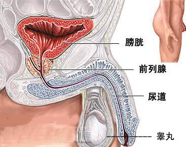 淺表性膀胱癌