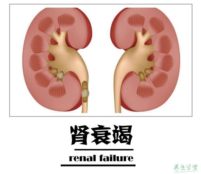 腎後性腎衰