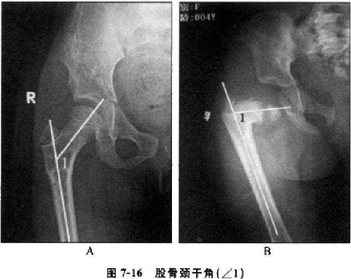 臀寬(髖最大寬)