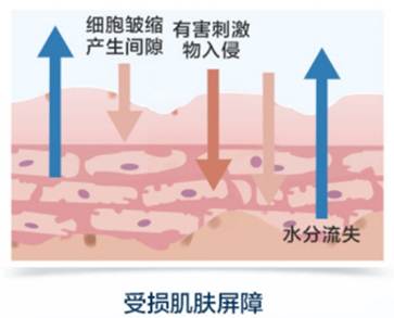 乾敏肌