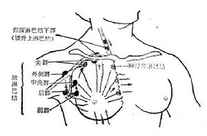 腋窩上淋巴結