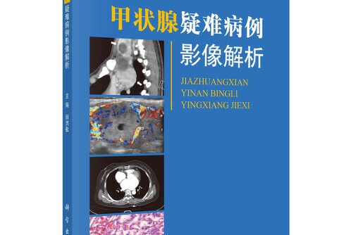 甲狀腺疑難病例影像解析