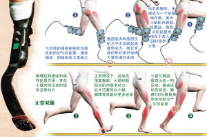 皮斯托瑞斯肌肉發力與正常人區別