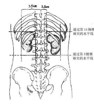 腎周圍炎