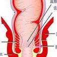 肛管括約肌橫斷