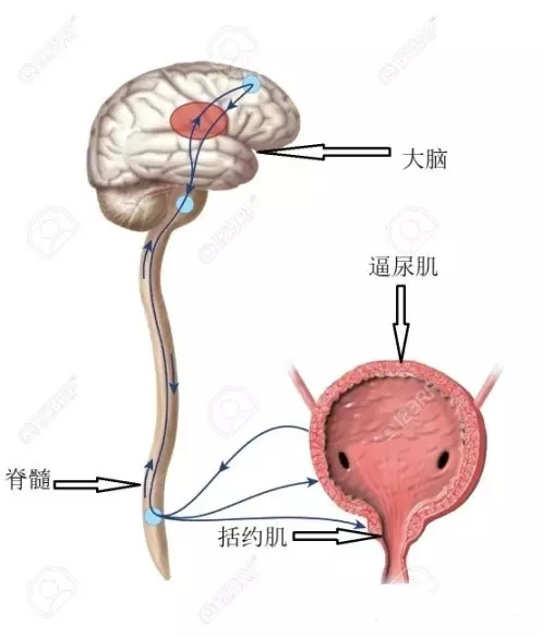 神經源性排尿功能障礙