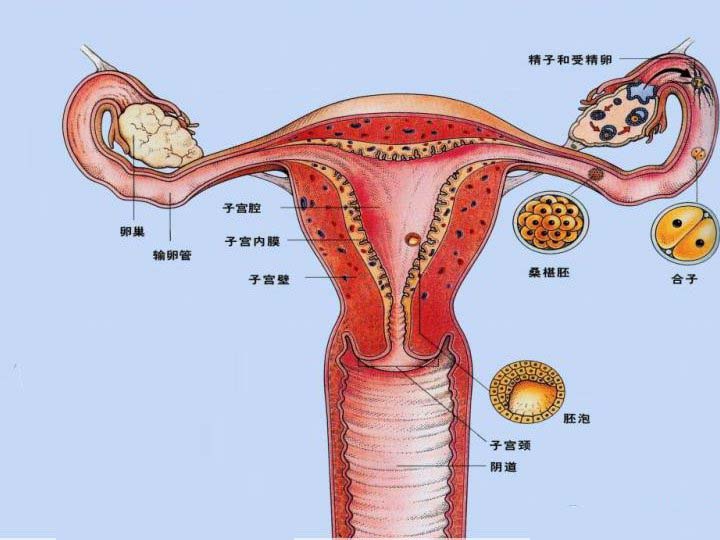 輸卵管堵塞通液術