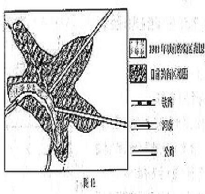 星狀城市形態