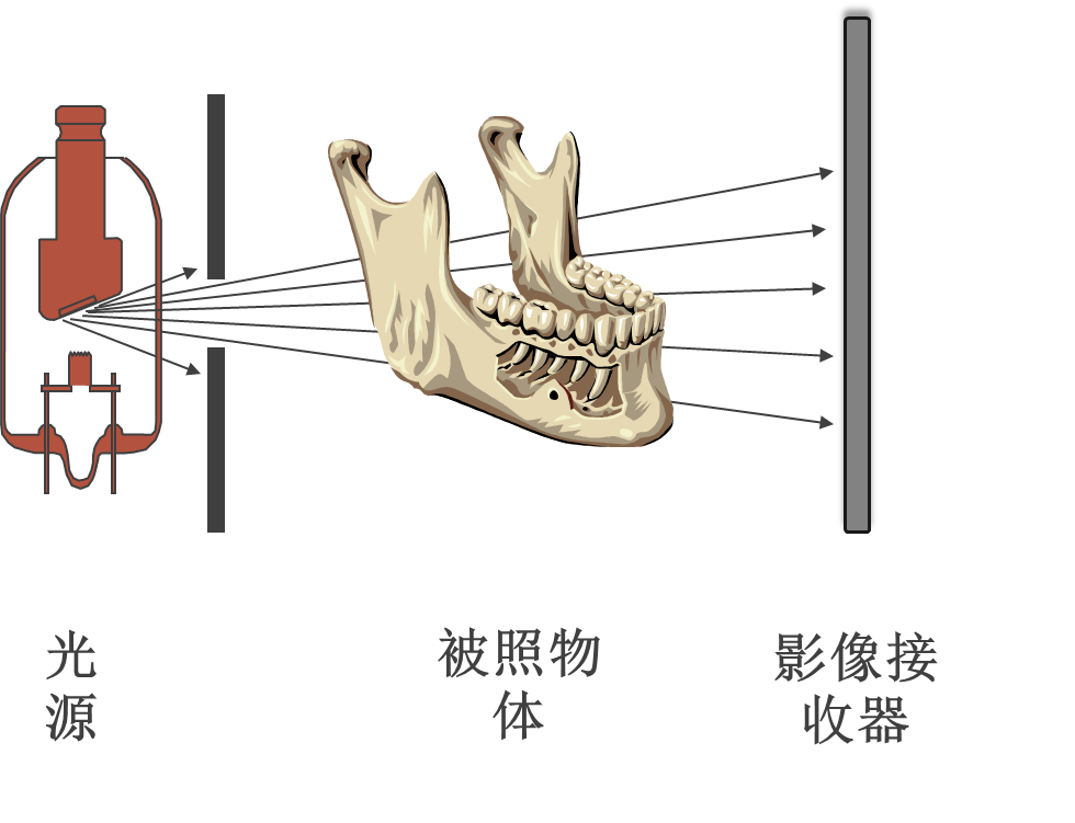 牙片機原理