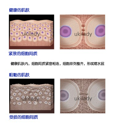 UKILady玉肌