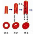 複方脈炎康