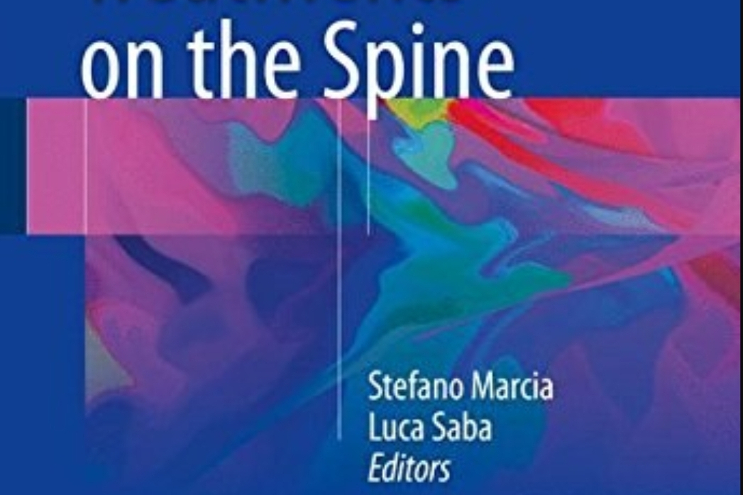 Radiofrequency Treatments on the Spine