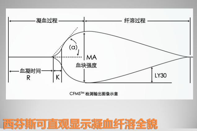 血栓彈力圖