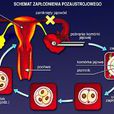 IVF(生命科學辭彙)