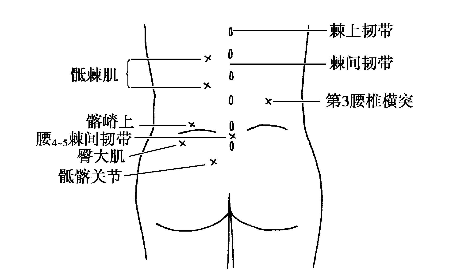 下腰痛